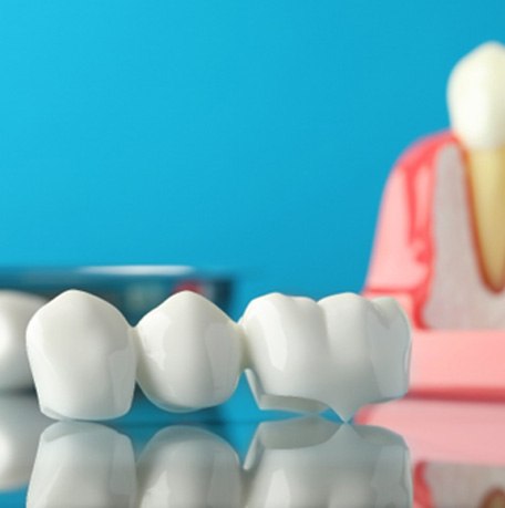 woman smiling after getting dentures 