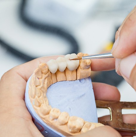 a person working on a dental bridge in Soldotna