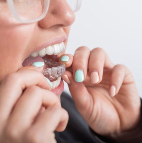 Closeup of person placing their clear correct tray