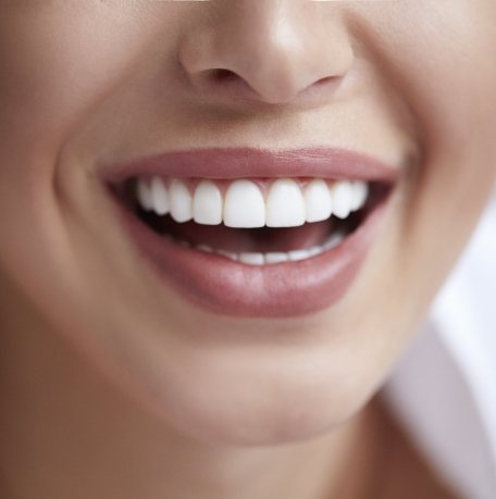 Closeup of smile after teeth whitening treatment