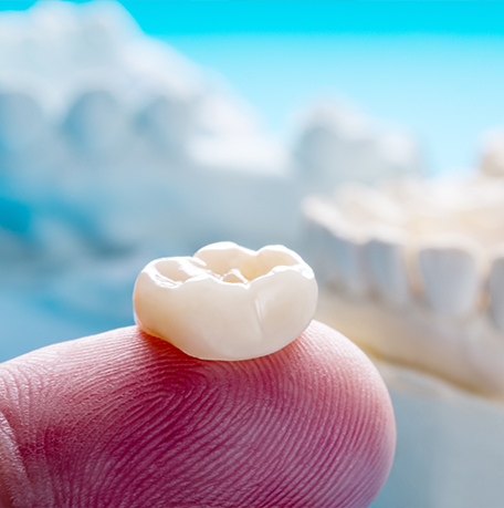 Close up of a dental crown resting on a finger