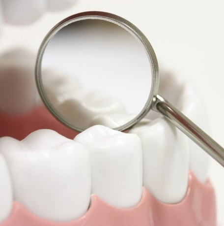 Dentist examining smile after placing dental sealants