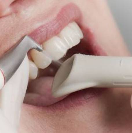 Dental patient receiving air flow polisher treatment