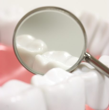 Closeup of smile with dental sealants