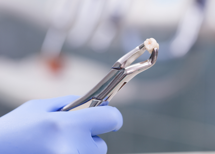 Tooth on forceps